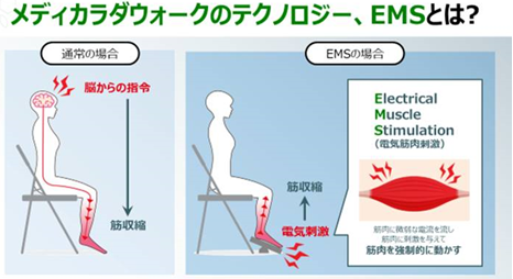 メディカラダウォーク （脚用運動機器）】どのような製品ですか? – Japan